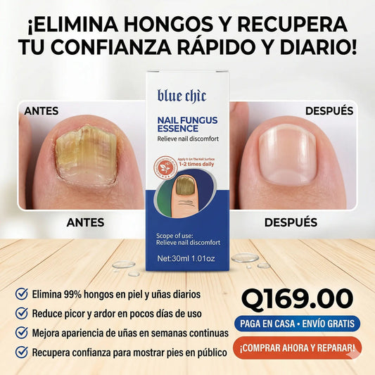 Reparador de uñas, elimina hongos y devuelve confianza al caminar y mostrar tus pies